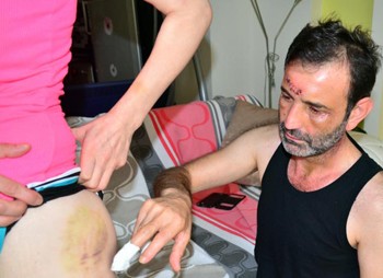 Ünye eski özel kalem müdürü ve kız arkadaşını dövdüler